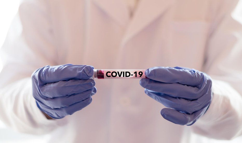 Fotografija: COVID-19 named by WHO for Novel coronavirus NCP concept. Doctor or lab technician holding blood sample with novel (new) coronavirus N.C.P. in Wuhan, Hubei Province, China, medical and healthcare FOTO: Pornpak Khunatorn Getty Images/istockphoto
