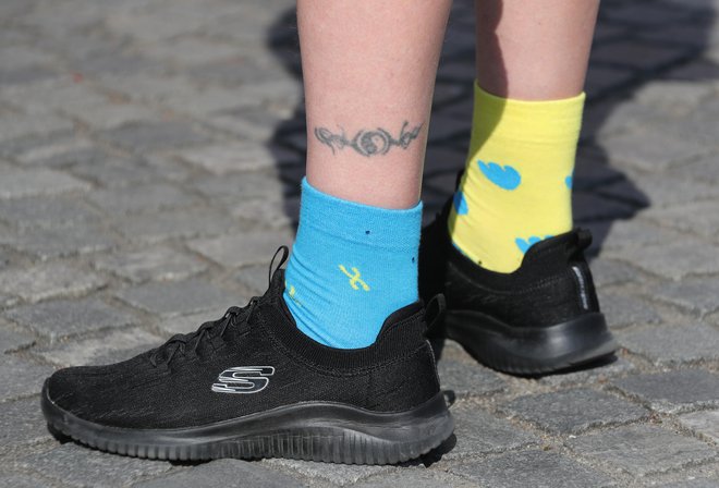 Različni nogavici nista le moda, ampak tudi simbol downovega sindroma.
