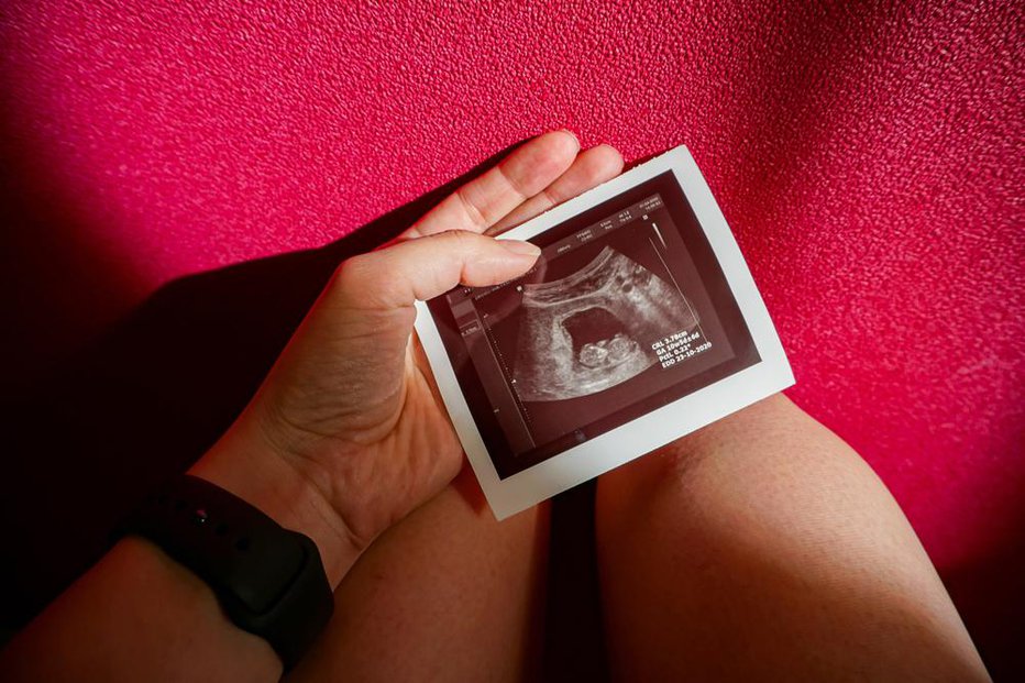 Fotografija: Trenutno je v Sloveniji prekinitev nosečnosti z zdravili dovoljena do desetega tedna nosečnosti, v nekaterih državah pa le do šestega tedna. FOTO: Love4aya/shutterstock