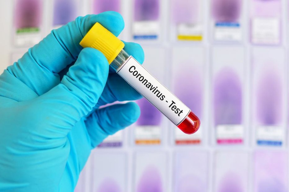 Fotografija: Več kot 60 odstotkov oseb, ki so se okužile z novim koronavirusom, je navedlo, da so imele po treh mesecih po preboleli prvi ali edini okužbi oziroma drugi okužbi še določene težave, ki so trajale vsaj dva meseca. FOTO: Getty images