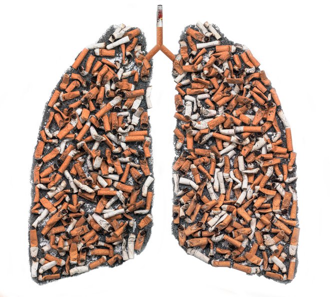 Pljučni rak je skoraj v 90 odstotkih posledica kajenja. FOTO: Getty Images