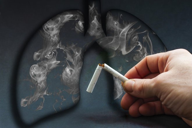 Kajenje je vzrok za kar 85–90 odstotkov primerov bolezni. FOTO: Aliaksei Kovaliou/Getty Images