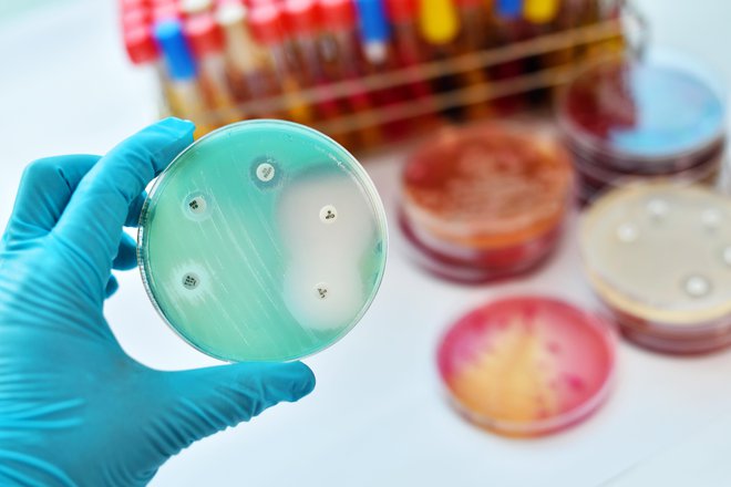 Sevi bakterij lahko postanejo odporni proti njim. FOTO: Jarun011/Getty Images