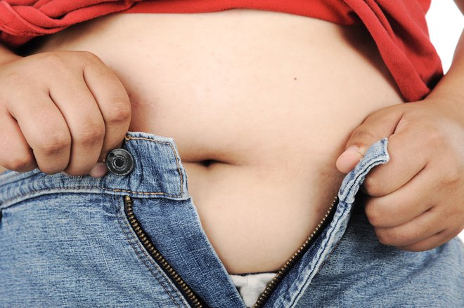 Zahvaljujoč zdravnikom ji je uspelo doseči težo 113 kilogramov. FOTO: Shutterstock 