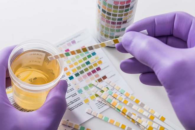 Laboratorijske in druge analize urina lahko razkrijejo marsikatero tegobo. FOTO: Lothar Drechsel/Getty Images