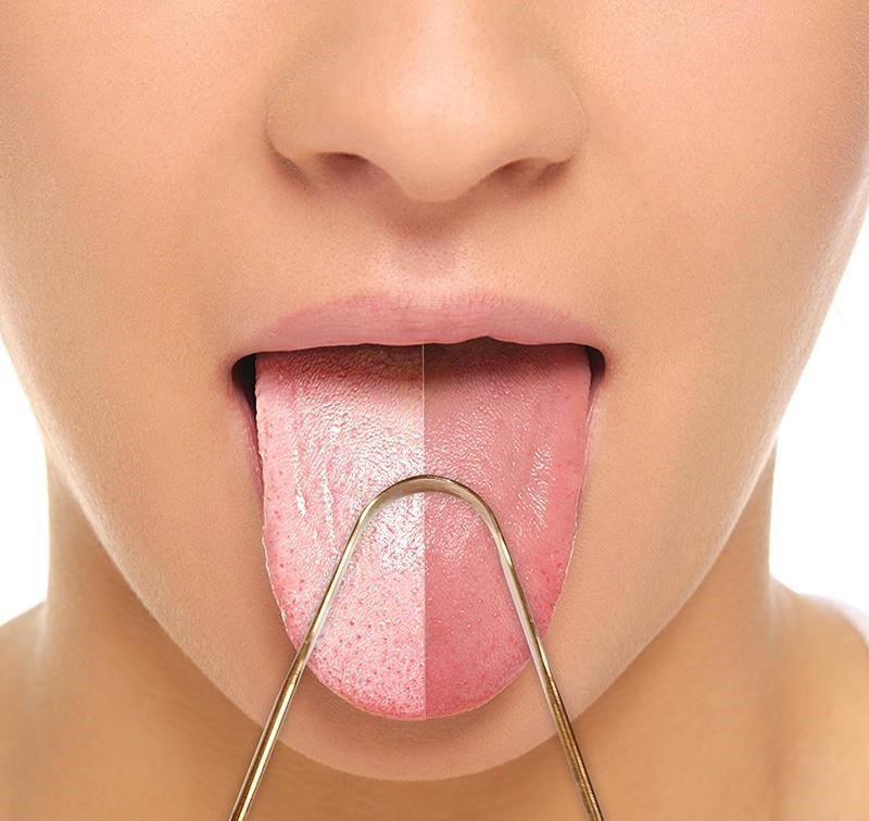Fotografija: Strgalo za jezik je prav tako nujen pripomoček kot zobna ščetka. FOTO: Arhiv proizvajalca