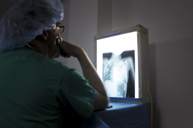 Izvedenec trdi, da je narava poškodbe indicirala takojšnjo kompletno rentgensko diagnostiko hrbtenice. Simbolična fotografija. FOTO: Reuters