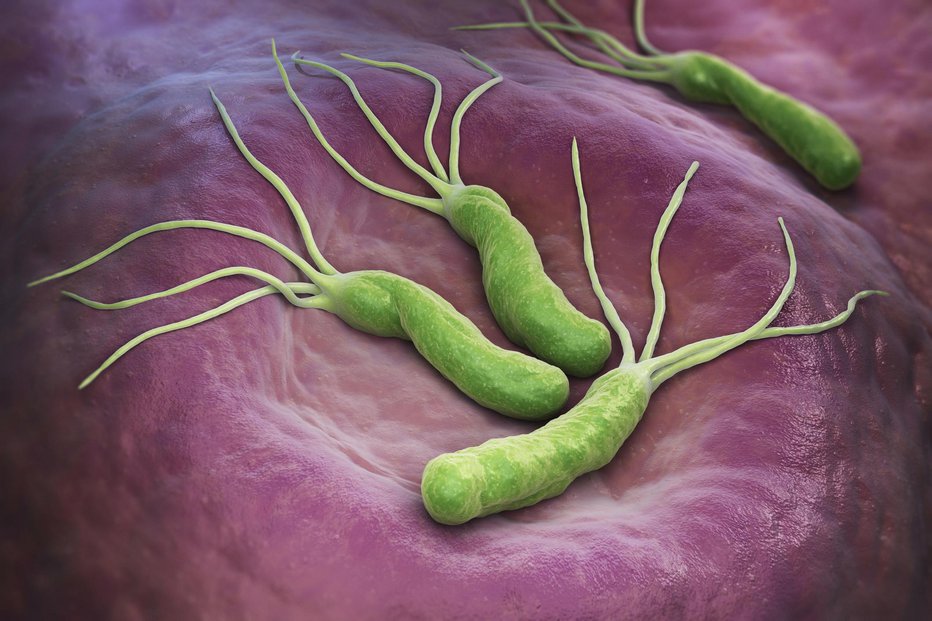 Fotografija: Helicobacter Pylori povečuje možnost za rak želodca, bakterija naj bi bila pogostejša pri skupinah A, B in AB. FOTO: Ilexx Getty Images/istockphoto