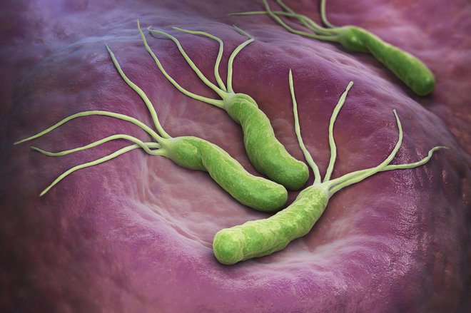 Helicobacter pylori povečuje možnost za raka želodca. FOTO: Ilexx/getty images
