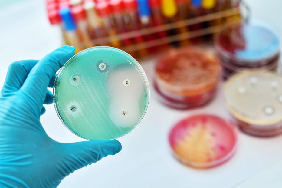 Fotografija: Sevi bakterij lahko postanejo odporni. FOTO: Jarun011 Getty Images/istockphoto